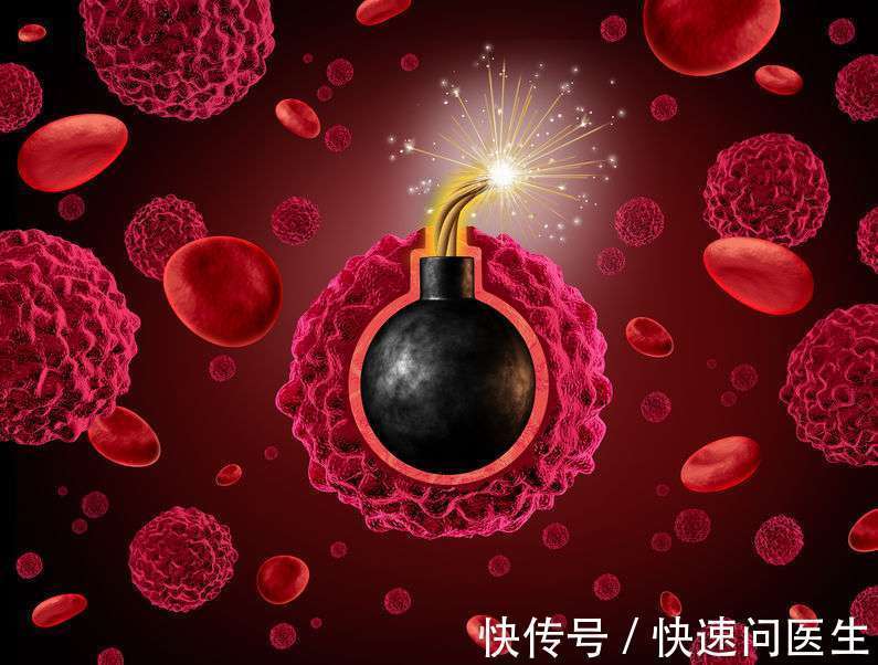 癌症|化疗会加速癌症患者死亡?关于化疗,这些真相你要了解清楚!