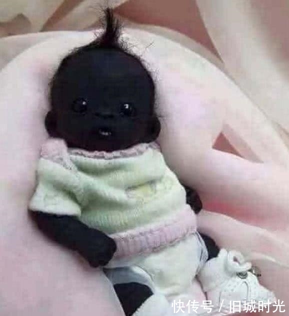 婴儿|世界上最“黑”的婴儿，早产不足4斤，4年过去竟然变成这样！