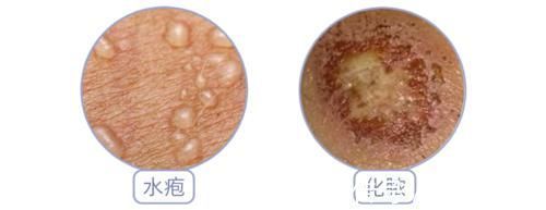 头皮|染发多了,容易致癌?答案很清楚:5点建议做到了,就能放心染