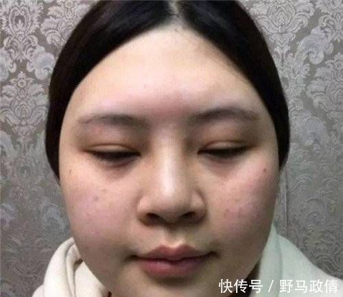 女孩子|3种被公认为“不忍直视”的脸型,神仙整容术也拯救不了你的颜值