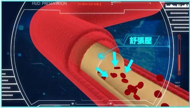 降脂药|吃低钠盐吃到心脏骤停?生活中暗藏的这些心血管致命陷阱,你一定要知道!