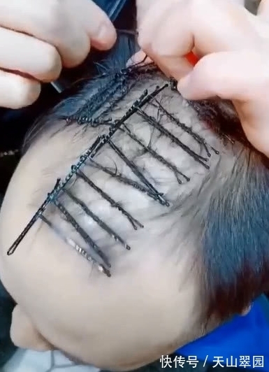 脱发|奇闻:男子秃头了还烫发,看到效果,网友:大叔变小鲜肉