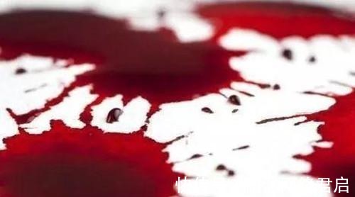 检查|女子害羞不刮毛, 忍了3年不手术, 再去医院医生说 晚了!