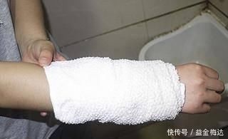 土方子|如果宝宝烫伤了宝妈们不要急,进来看看我教你!