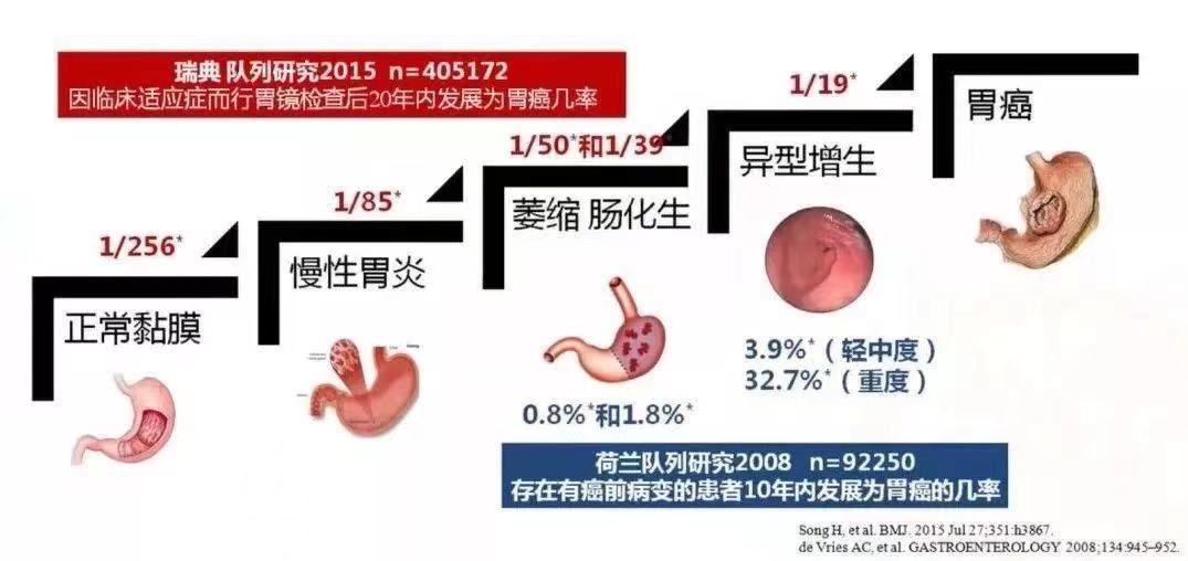 年轻人|年轻人胃癌发病率翻番！从“胃炎”变“胃癌”，一共分几步？