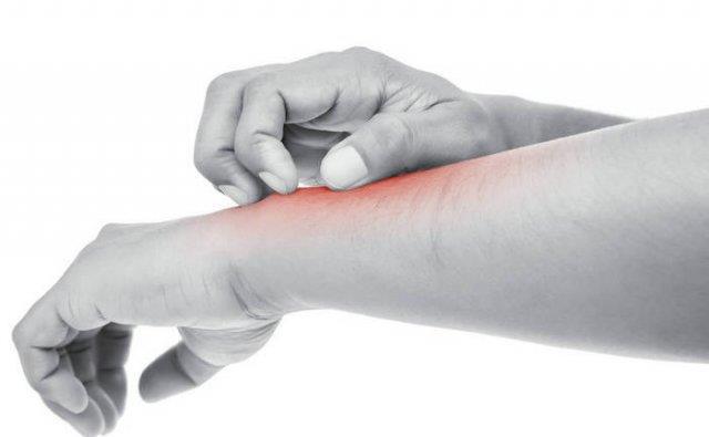 皮肤过敏|皮肤出现四种异常,别傻傻的认为是皮肤过敏,有可能是肝病的前兆