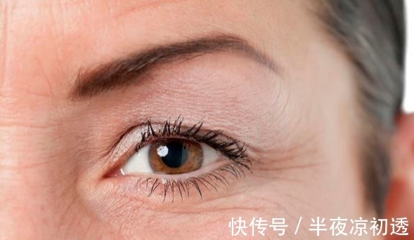 皱纹 细纹干纹分不清?不同皱纹不同策略,正确护肤让你事半功倍