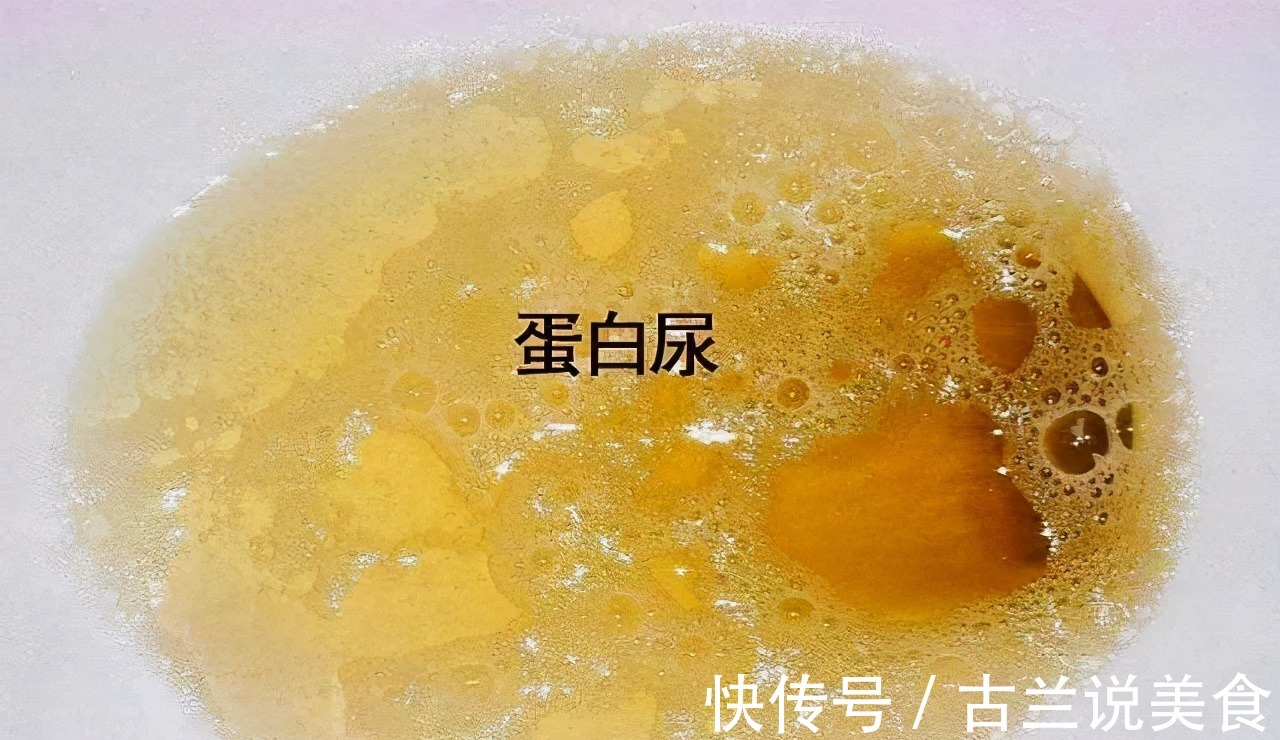 肾脏|29岁小伙,查出肾衰竭,女朋友改嫁他人,悔哭不该乱吃东西