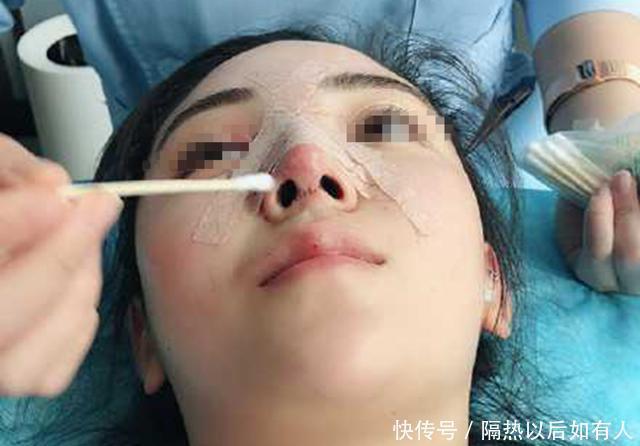 理发店|28元的洗脸除螨,女子结账被收8000元,遇到消费欺诈只能忍气吞声?