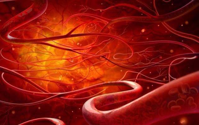 食物|食物中的“阿司匹林”被发现,坚持多食,血管可能会越来越顺畅