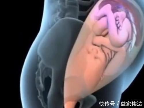 羊膜囊|顺产的全过程到底是怎样的,生而为人需了解,请勿泪奔