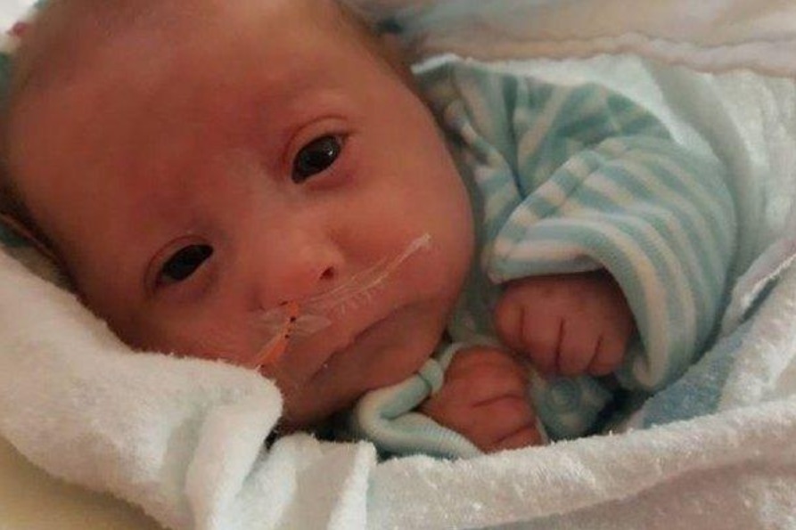 小头症|世界上最小的婴儿,曾经把蛋壳当成摇篮,如今却变成了这副模样!