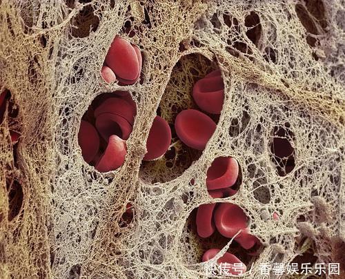 3种调味剂,比糖和盐更“伤身”你或许经常吃,怪不得血管会堵