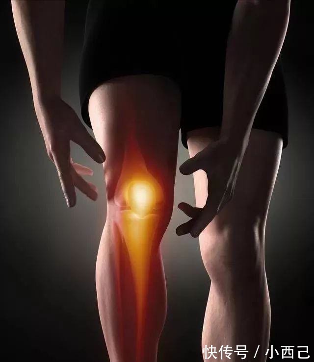 膝关节|四神煎治疗膝关节肿大积水，膝盖疼再也不用求医问药了