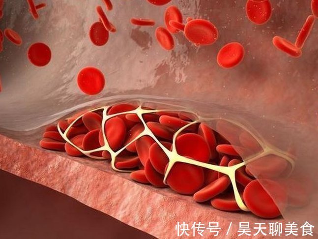 功效|血栓遇到大克星，3种天然“阿司匹林”，常吃血管通畅保健康