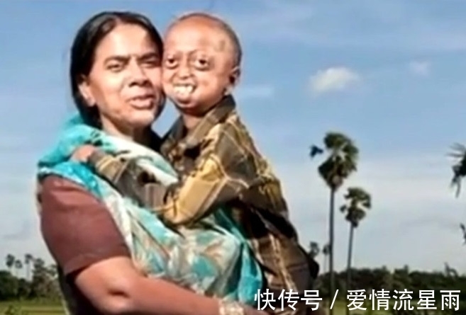 夫妇|【奇闻】印度夫妇生下6个“外星人”,求助医生,医生大骂:无知