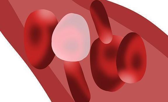 频繁|猝死前,会发出4大信号,很多人容易不当回事,及早发现或能保命