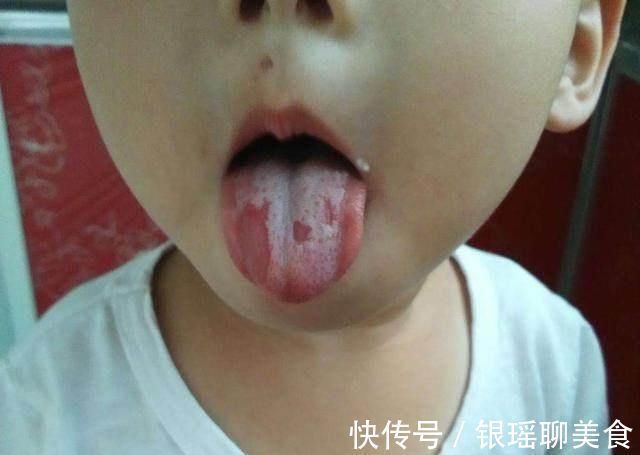 告诫|儿科医生告诫2件事堪称宝宝脾胃杀手,很多家长在做,简直坑娃