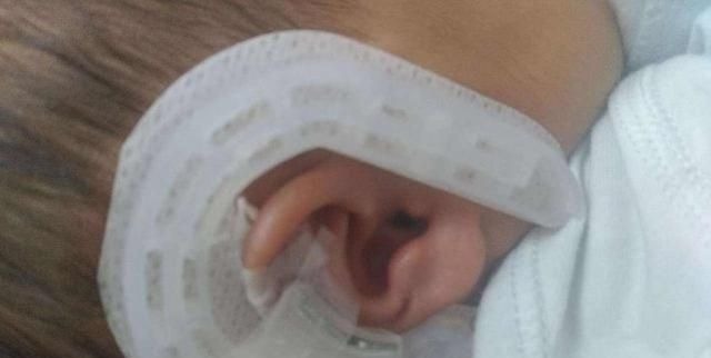 胎儿|按时产检却生下“畸形儿”这些问题检查时很难发现,孕妈要知道