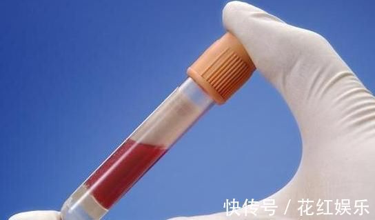 血液流变学|高血脂人群,牢记:常吃1物,稳定血脂清理血管,赶走健康隐患!