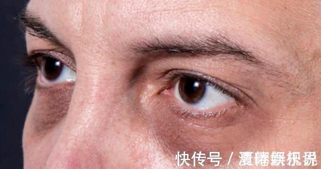 病变|肝脏变硬，头部先知医生头部若有3个表现，或提示该养肝了