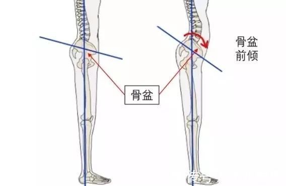 踝关节 它让你美丽十足,也让你伤害万分!高跟鞋的五大伤害你中招几个