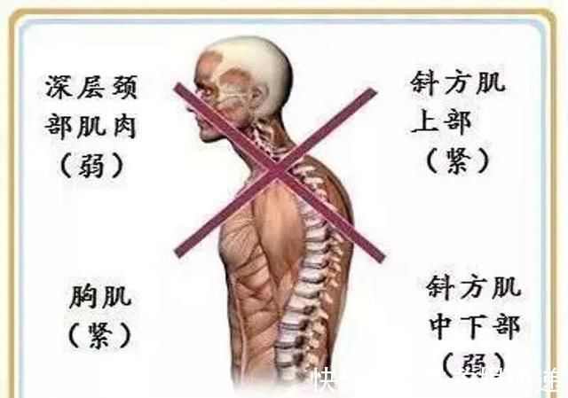 上胸|上胸发力总不好、练不大,原来是因为“它”,我们应该如何改善