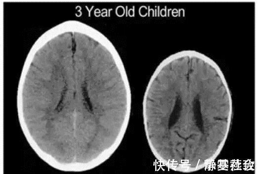 婴儿期|娃的大脑发育高峰期仅有一次,做到这3点,就能拉开孩子间的差距