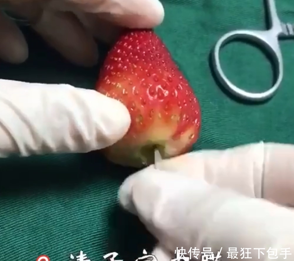 夫妻|人流对女性伤害有多大?看完这组“草莓”模拟图,夫妻决定避孕