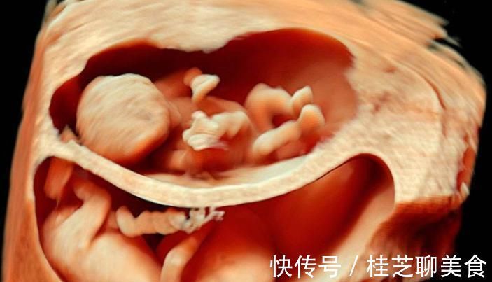 窒息|孕妈睡觉时，胎儿在干嘛？看到这个画面，小家伙真的太可爱了
