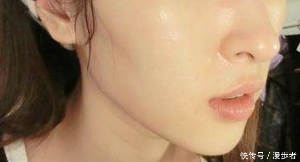 脸上螨虫滋生长痘？不妨用厨房里的这样两样东西，每天抹下全消失