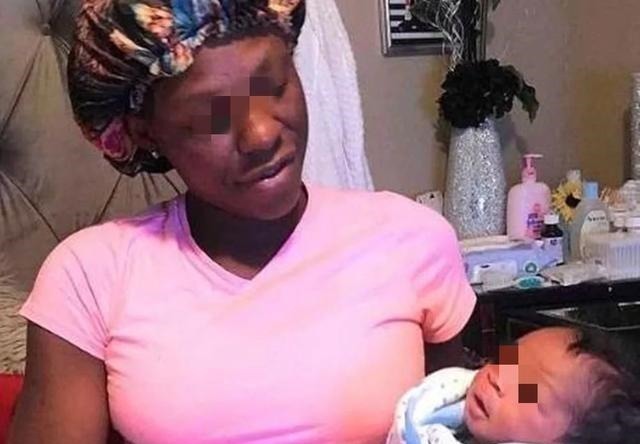 每日邮报|“最美胎记”,姐姐在胎中被弟弟吸收,变成胎记留在弟弟腿上