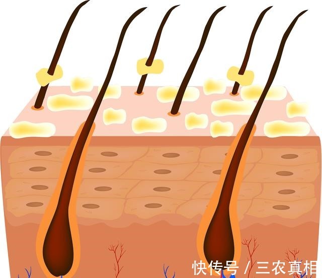 红石榴 护肤套装不同品牌什么值得入!
