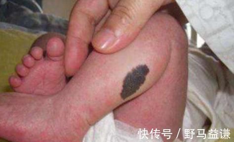 化妆|怀孕后,孕妈常有这3个“坏习惯”,宝宝易长胎记,一定要多留心