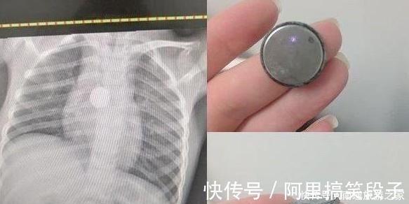 暖风器|安全教育需谨慎,生活中注意不到的小细节,会让孩子受到伤害