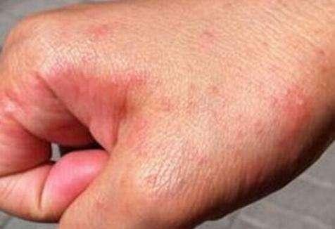 核桃|糖尿病四个征兆你中几个6种天然降糖食物,坚持吃,预防糖尿病