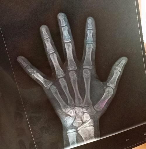 青春期|男孩长到180,女孩长到165,爸妈做好这3点,有希望