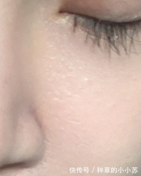 虾青素|洁面不当可能导致“毁容”,请重新认知洁面的重要性