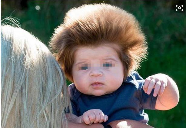 惊呆|女子怀孕时被闪电击中,孩子出生后,众人都惊呆了