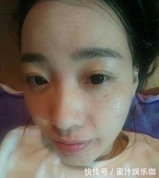 药店|药店的一粒它,大妈每天用它抹脸,坚持五次祛斑,皮肤白嫩有弹性