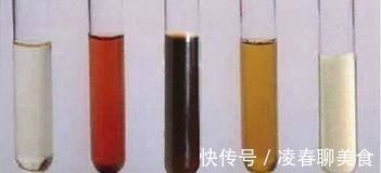 医生|小伙肝癌缠身,花光积蓄后离世,医生遗憾一种东西不能天天吃