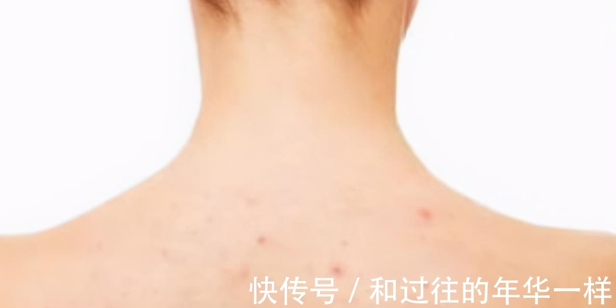 国医|国医泰斗张锡纯：擅长用它清掉体内的6种垃圾！可惜很多人都扔掉
