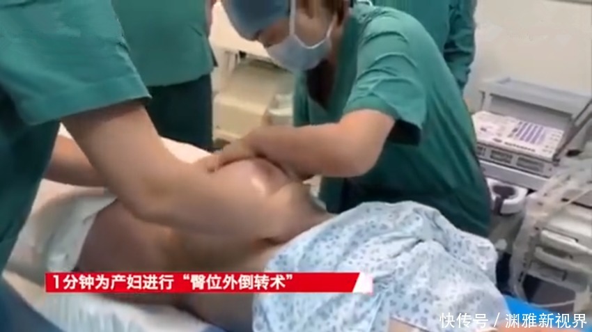 枕前位|堪称魔术!1分钟剖宫产变顺产,医院产房上演胎位“乾坤大挪移”