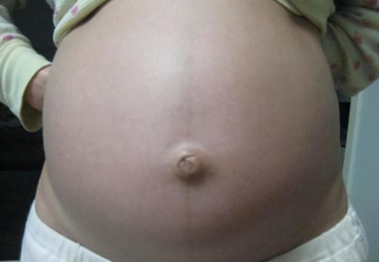 准妈妈|准妈妈肚皮被“盯上了”，孕肚的几个特点，跟胎宝性别有关吗？