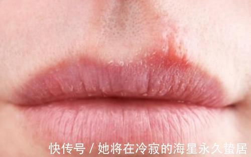 胃部|胃不好能吃葡萄吗？提醒：不想胃病“纠缠不休”，3种水果需少吃