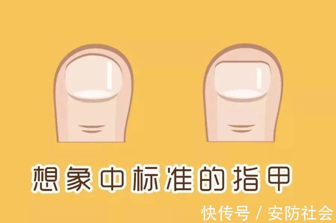 指甲缝|指甲剪不对带来大麻烦,这才是剪指甲的正确方法!