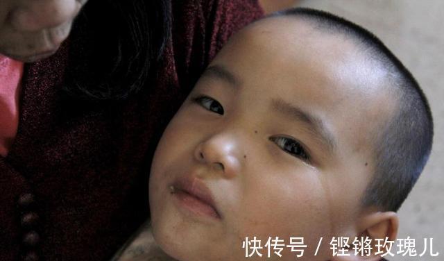 后遗症|孙子连续发高烧,奶奶以为着凉仅喂退烧药,结果害了孩子一辈子