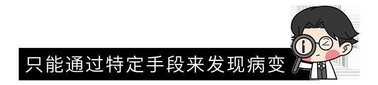 杨学宁|为什么中国肺癌患者越来越多？直言不讳：除了抽烟，还有5大诱因