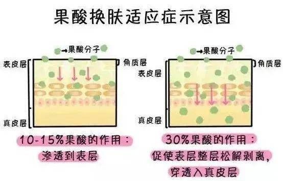 果酸|刷酸前必看！关于果酸焕肤，这些知识点你一定要知道