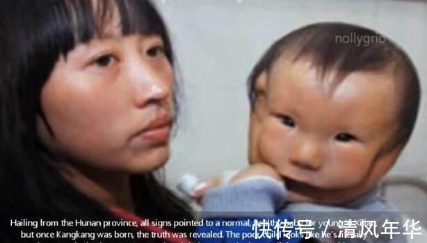 妈妈|宝宝安全出生,可妈妈看到宝宝的样子失声痛哭!